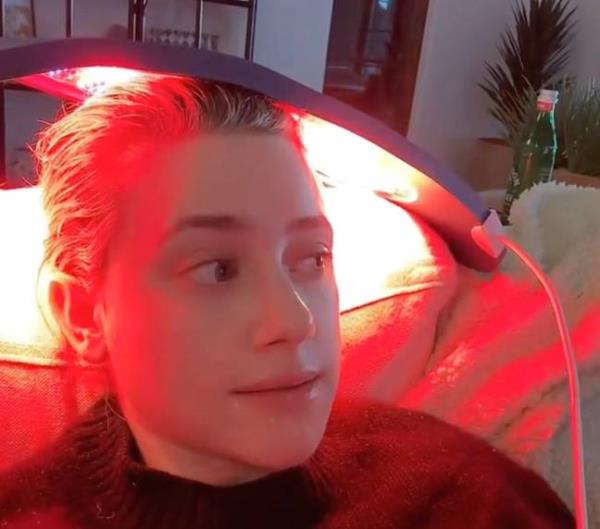 Lili Reinhart has been undergoing treatment for her alopecia. Credit: TikTok/@lilireinhart