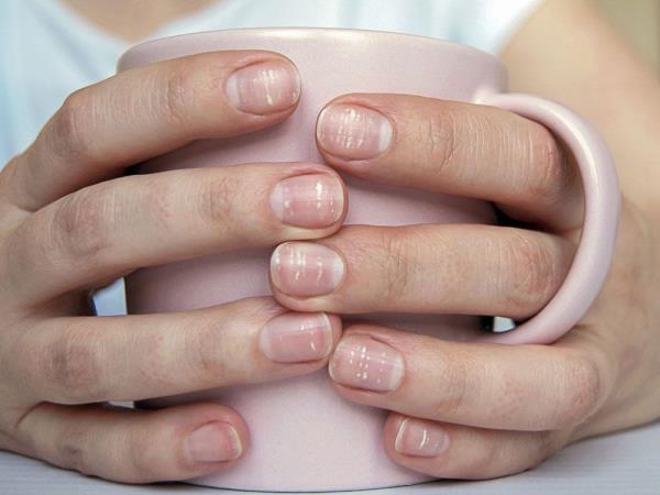 Nail health is not something you want to self-treat. It's easy to get the diagnosis wrong because many nail issues look similar.