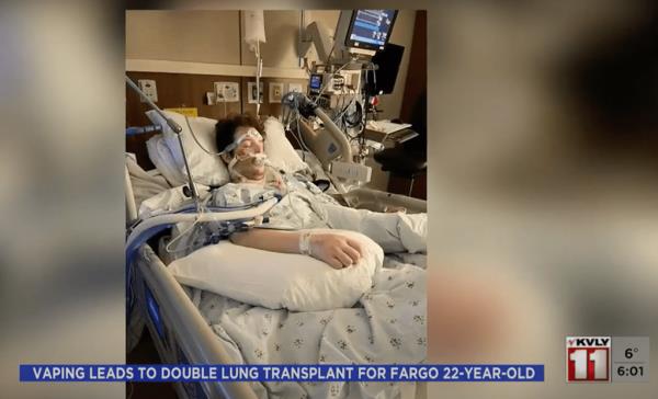 According to his family, Allard was a heavy vaper, saying 