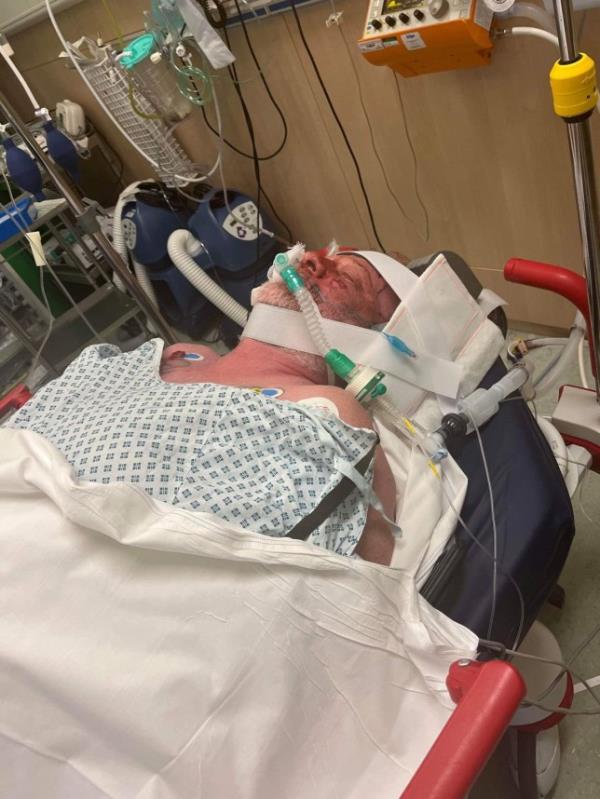 Neil Anderson, 52, in hospital. Release date - 15/10/23. See SWNS story SWLNescalator. A man has been left fighting for his life in a coma after tumbling 100ft down a non-moving escalator. Neil Anderson, 52, had been for a meal with a friend when he stepped o<em></em>nto an escalator at Do<em></em>ncaster Interchange in South Yorkshire. However, he realised that it was actually broken and wasn't moving - but by the time the B&Q worker could get off, he fell from the top to the bottom. He then had two cardiac arrests, was pro<em></em>nounced dead for eight minutes at the scene and then was taken to nearby Do<em></em>ncaster Royal Infirmary.