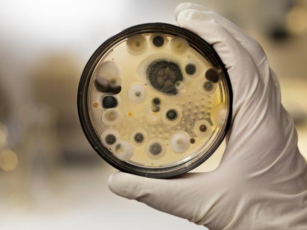 mold growing in a petri dish