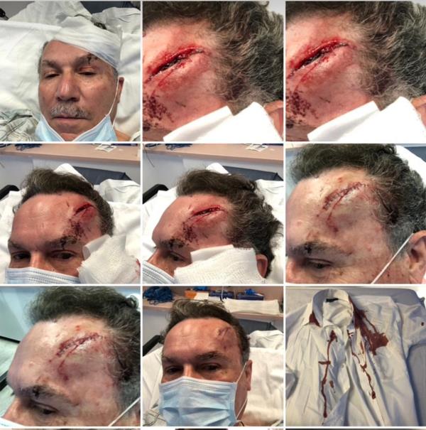 Acevedo, who ended up retiring in the wake of his bloodied assault after 47 years at the store, was left with a gaping gash in his forehead
