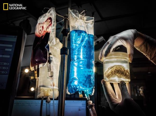 Yale researchers successfully reanimated dead tissue in a pig's brain.
