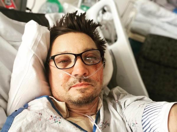 In January, the Oscar nominee was severely injured after a snowplow ran over his leg, shattering more than 30 bones.